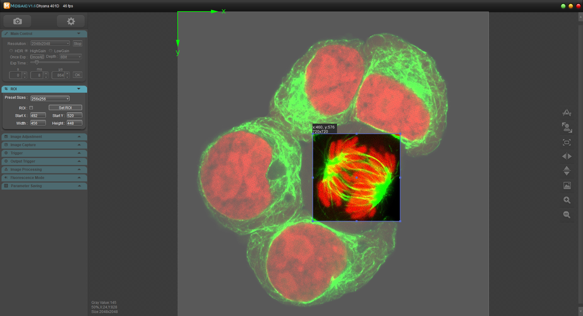 什么是感興趣區(qū)域（ROI）